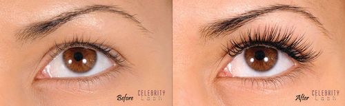 Precise and accurate application means seamless extensions